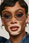 Winnie Harlow